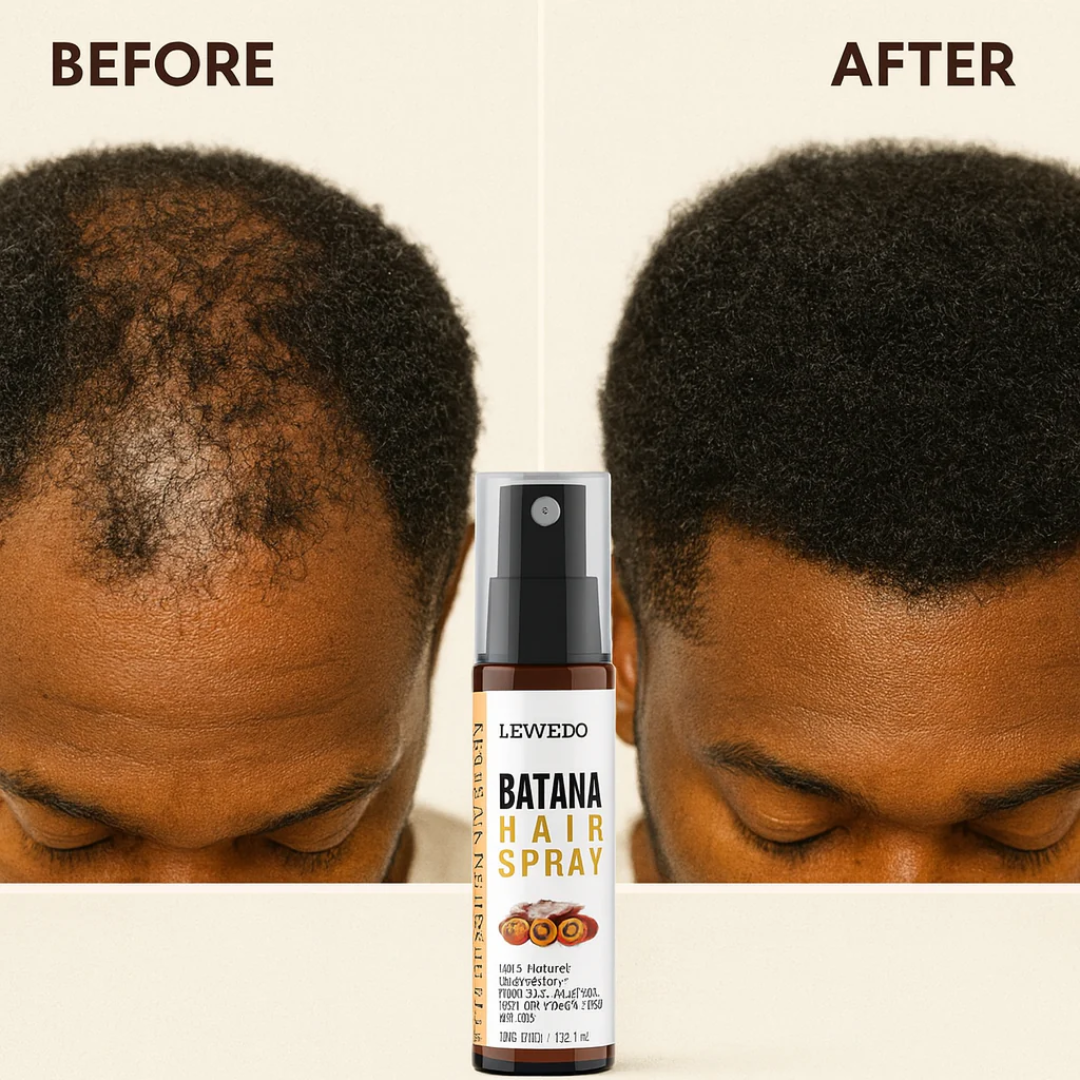Batana Hair Growth Spray